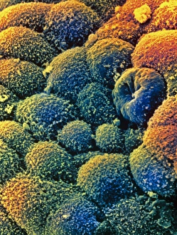 Electron Microscope Images Prints: m8500351