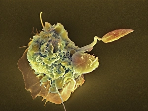Immune System Cells Prints: Macrophage attacking a foreign body, SEM