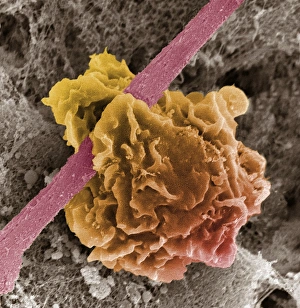 White Blood Cell Biology Prints: Macrophage ingesting debris, SEM