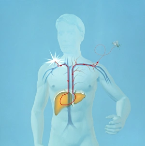 Malaria in the body Malaria in the body