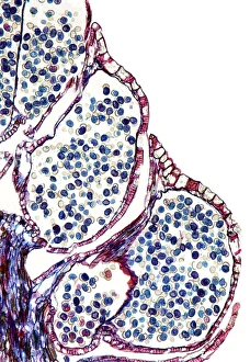 Pollen Grain Morphology Prints: Male pine cone, light micrograph