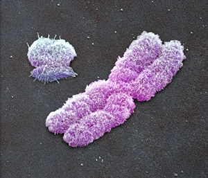 Male sex chromosomes, SEM Male sex chromosomes, SEM