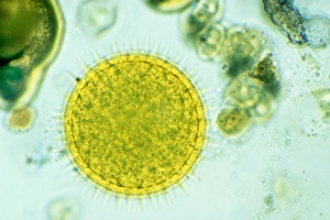 Pollen Grain Structure Prints: Mallow pollen, light micrograph