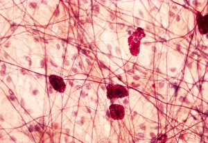 White Blood Cell Types Prints: Mast cells, light micrograph