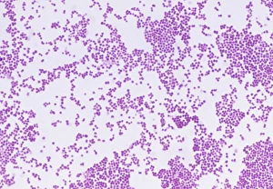 Images Dated 5th March 2003: Meningitis Bacteria Print