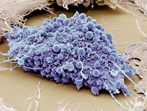 SEM Print of a Human Mesenchymal Stem Cell