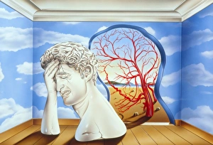 Migraine Migraine