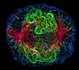 Prints of Mitosis. Fluorescence micrograph of a cell during prometaphase of mitosis (nuclear division). During mitosis two daughter nuclei are formed from one parent nucleus Images Dated 2004 July: Fluorescence Micrograph Print of Mitosis in Prometaphase