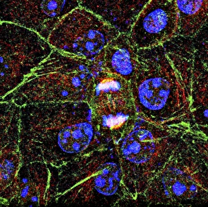 Cell Division Prints: Mitosis, fluorescence micrograph
