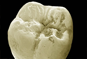 Molar Tooth Print, SEM