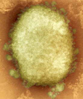 Coloured TEM Images Prints: Monkeypox virus particle, TEM