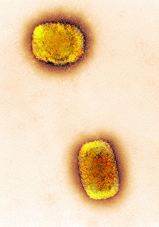 Coloured TEM Images Prints: Monkeypox virus particles, TEM C016 / 7384