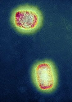 Monkeypox virus particles, TEM Print