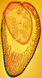Polarised Light Micrograph Prints: Moss spore capsule, light micrograph