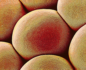 Compound Eye Structure Prints: Moth eye lens, SEM