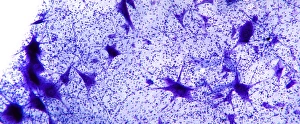 Nerve Cell Structure Prints: Motor neurones, light micrograph