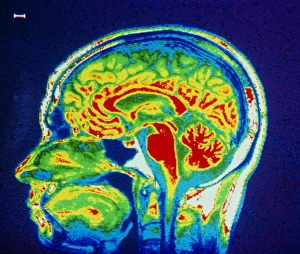 Images Dated 1986: False-colour MRI scan print of a human brain