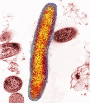Transmission Electron Micrograph TEM Prints: Mycobacterium bacteria, TEM