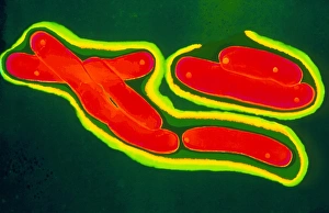Mycobacterium Tuberculosis Prints: Mycobacterium tuberculosis bacteria