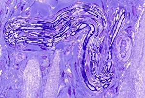 Light Micrograph Prints: Myelinated nerve, light micrograph