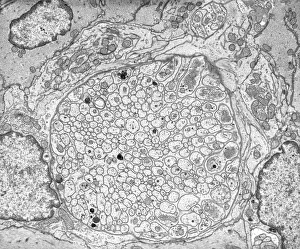 Transmission Electron Micrograph TEM Prints: Myenteric nerve plexus, TEM