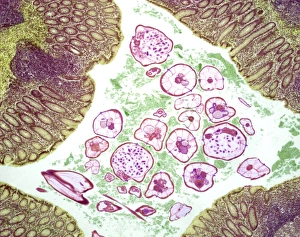 Light Microscopy Images Prints: Nematode infection, light micrograph