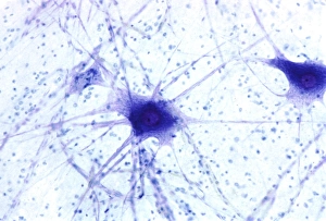 Nerve Cells Prints: Nerve cells, light micrograph