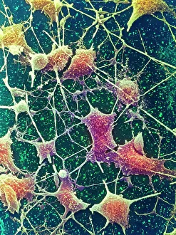 SEM Nerve Cell Print, Coloured Scanning Electron Micrograph