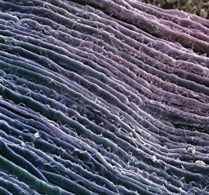 Nerve fibres Nerve fibres