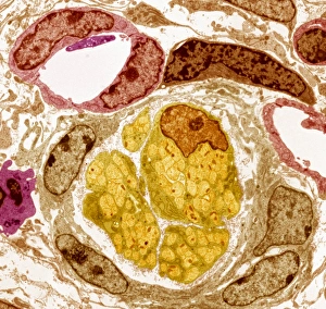Transmission Electron Micrograph Prints: Neurovascular bundle, TEM