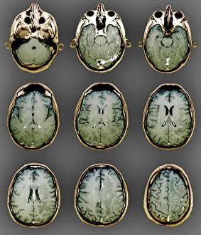 Images Dated 2011: Normal Brain MRI Scan Print: Coloured Axial Section