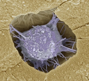 SEM Print of Osteoblast Bone Cell
