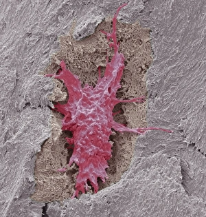 Images Dated 21st August 2013: Coloured SEM Print of Osteocyte Bone Cell