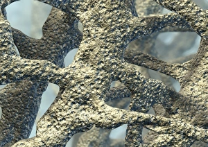 Osteoporotic bone Print