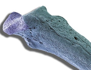 Images Dated 16th July 2008: Osteoporotic bone print, SEM