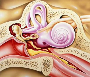 Otitis media of ear Otitis media of ear