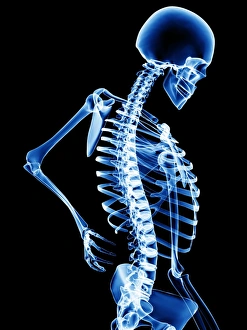 Back Pain Print