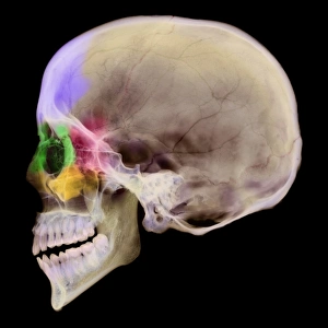 Paranasal sinuses, X-ray Paranasal sinuses, X-ray