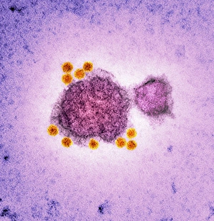 Coloured TEM Micrograph Prints: Parvovirus particles, TEM