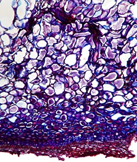Prints of Pear scab infection. Light micrograph of a section through a pear (Pyrus sp.) infected with the Venturia pirinum fungus. This fungus causes scab, or black spot, of the pear fruit Images Dated 2012 February: Pear scab infection Print, x70 magnification