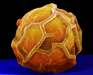 Scanning Electron Microscopy Photos Prints: Peppercorn, SEM