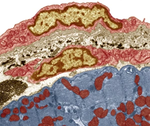 TEM Print of Serous Pericardium