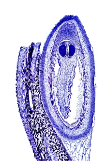 Images Dated 3rd January 2006: Pine cone scale Print, Light Micrograph