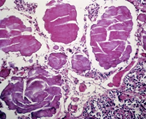Images Dated 21st February 2013: Pineal Gland Light Micrograph Print