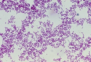 Plague bacteria Plague bacteria
