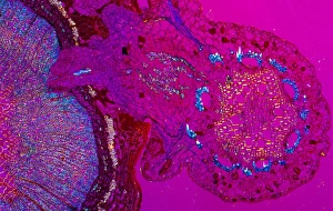 Parasitic Plants Prints: Plant parasite, light micrograph