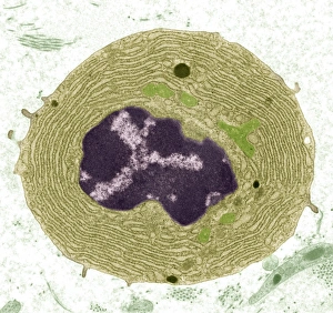 Plasma Cell Print, TEM Micrograph