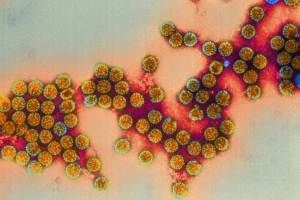 Polyoma viruses Polyoma viruses