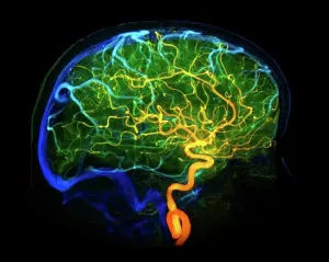 Scientific Posters: 3D Coloured Angiogram Print of Brain Blood Vessels