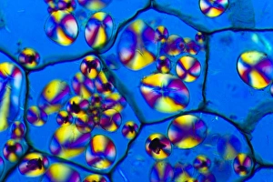 Polarised Light Microscopy Prints: Potato starch grains, light micrograph